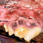 A step-by-step guide to surgical extraction of the maxillary fourth premolar